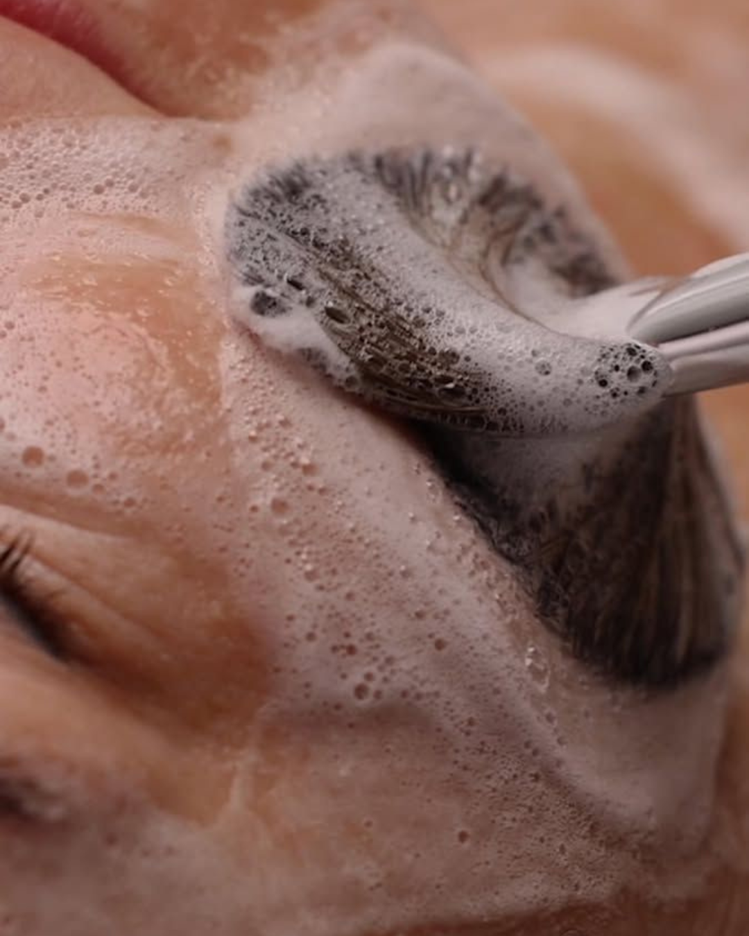 Why Your Skin Looks Dull After Summer (And What to Do About It)
