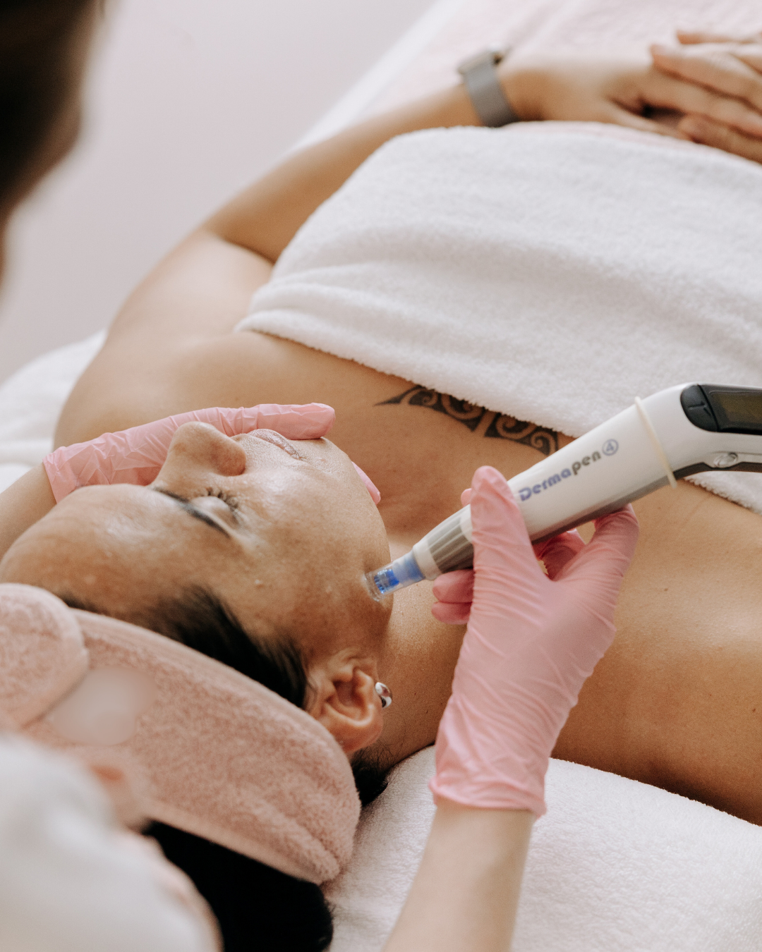 woman on a comfortabel massage bed receiving microneedling with a Dermapen 4 at Reveal 