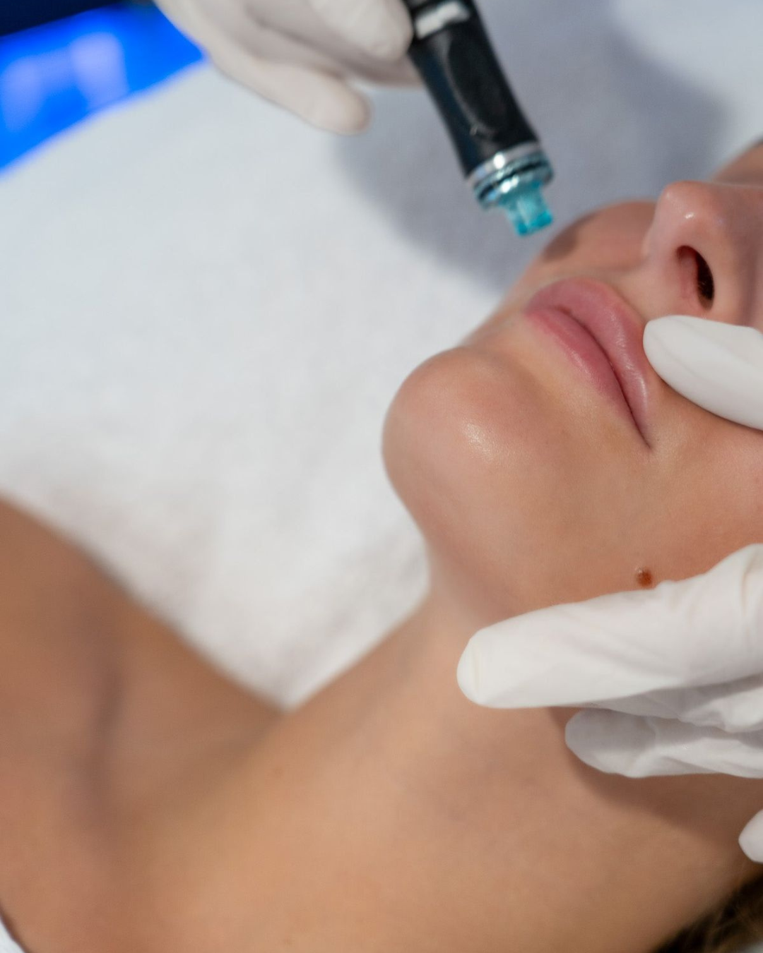Sculpt Hydrafacials