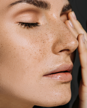 Microneedling | Collagen Induction Therapy (CIT)
