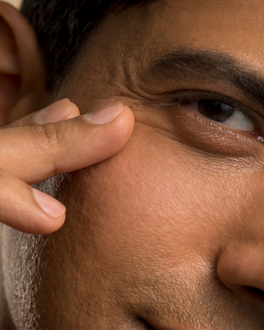 Senior beauty therapist microneedling treatment Reveal Hair Skin Body Mount Maunganui Papamoa
