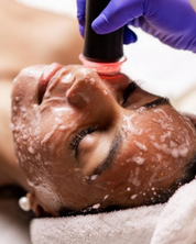 RF Oxygenx+ Facial